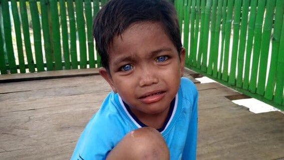 Salah seorang anak dengan mata biru dari Sulawesi Tenggara. (Kronologi.id)