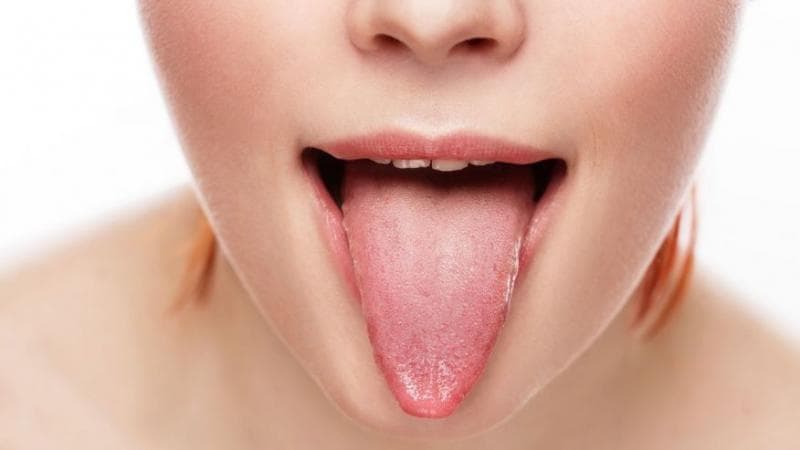 Benjolan di lidah paling sering didapati pada pasien Covid-19. (Shutterstock)<br>