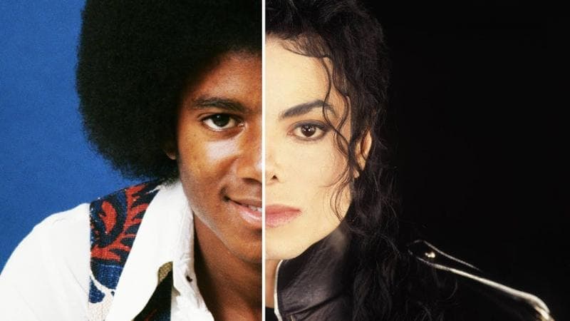 Perubahan warna kulit Michael Jackson. (Grid)